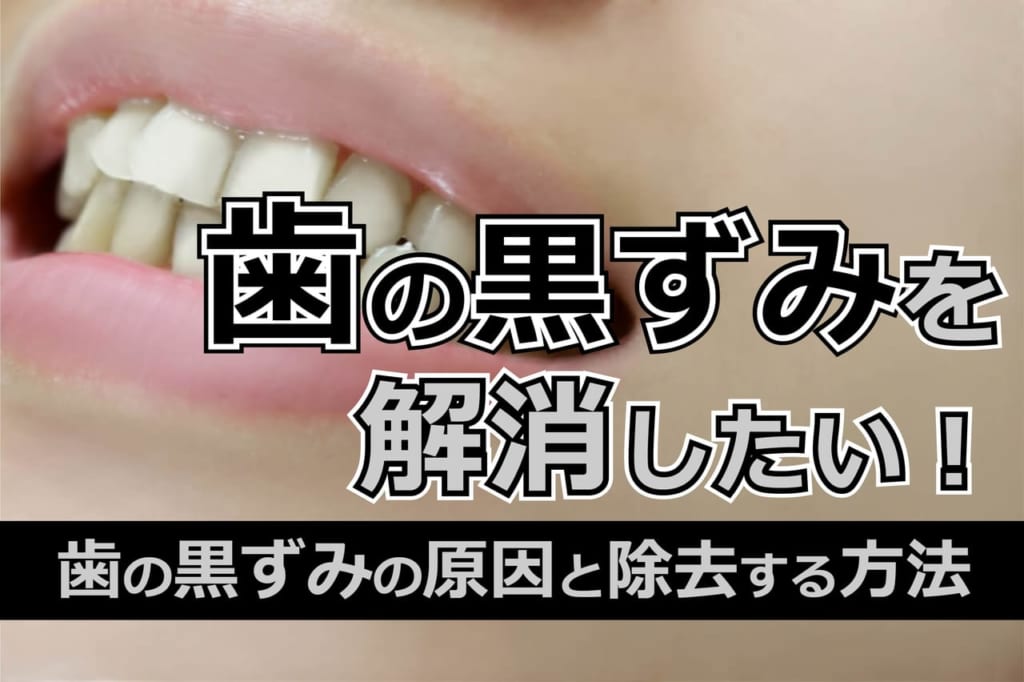 歯の黒ずみを解消したい！歯の黒ずみの原因と除去する方法